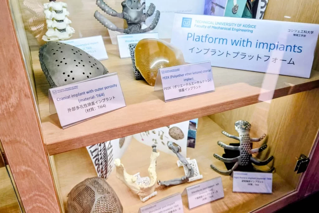 骨のインプラント